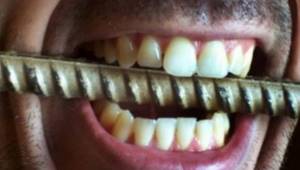 Скрежет зубами лечение народными средствами